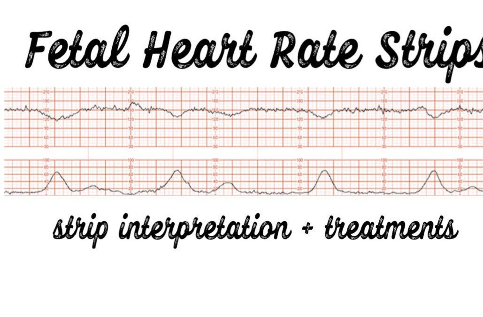 Fetal heart rate strip study guide FHR interpretation Etsy