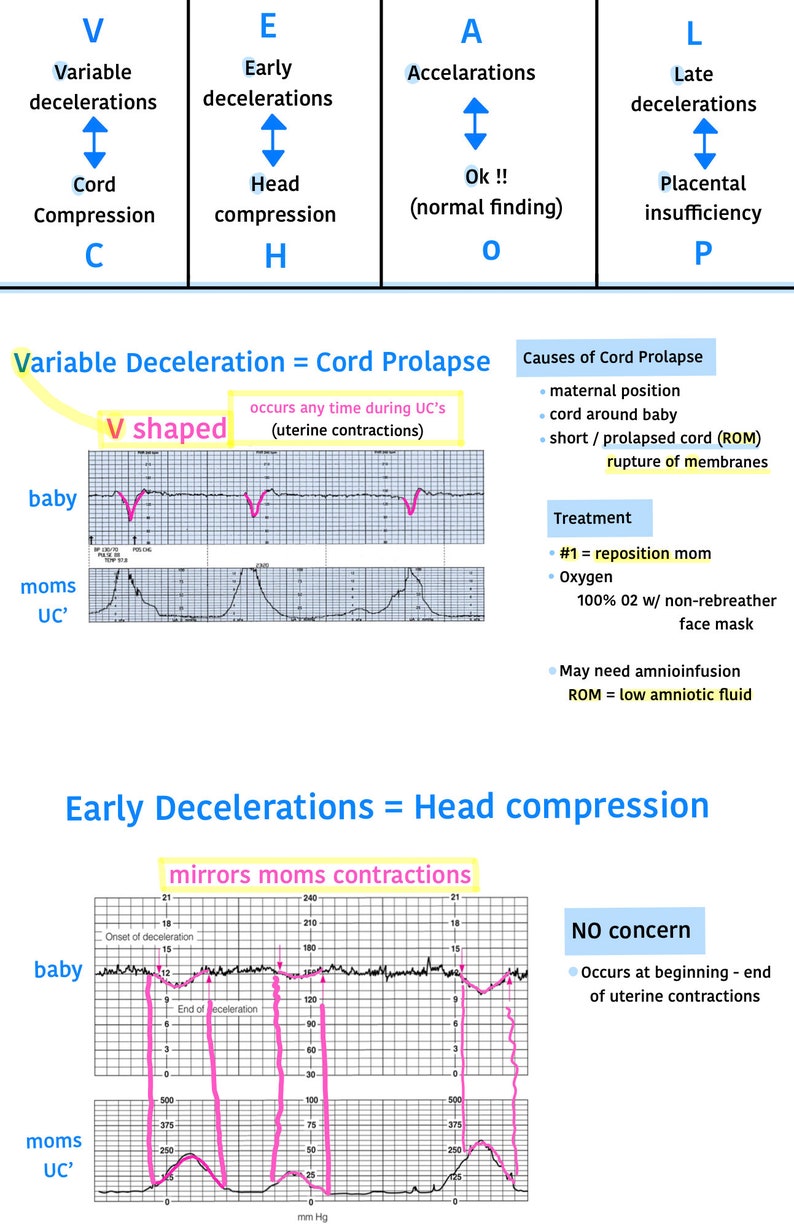 Fetal Heart Rate Interpretation, Fetal Heart Strips, Labor and Delivery