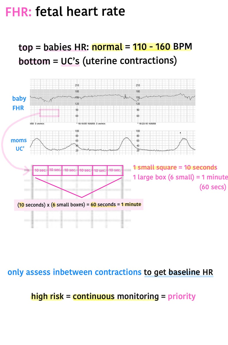 Fetal Heart Rate Interpretation, Fetal Heart Strips, Labor and Delivery