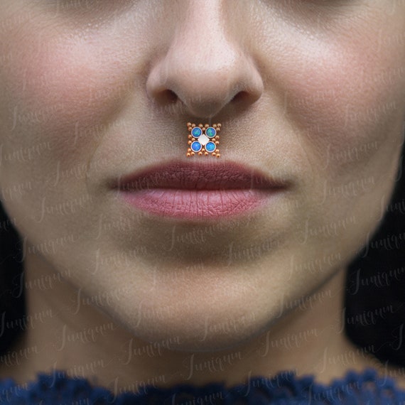 Philtrum ring clearance