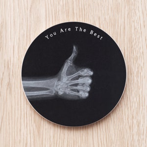 Könnte beinhalten: Ein schwarzweißes Röntgenbild einer Hand, die einen Daumen nach oben zeigt. Das Bild befindet sich auf einem runden Untersetzer mit dem Text "You Are The Best" am Rand.