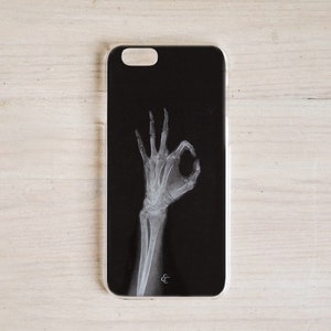 black and white XRay skeleton hand Custom Phone Case iphone 15 14 13 12 samsung s23 s22 pixel radiologist radiology rad tech halloween gift