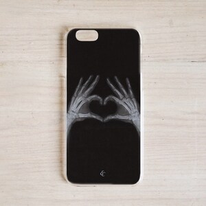 Xray skeleton hand personalized halloween phone case radiologist radiology heart hands bone Radiologic Technologist rad tech valentine's day