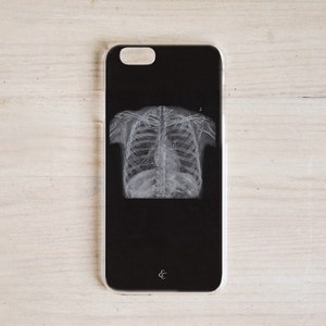 Chest XRay rib cage Personalized Phone Case, samsung Pulmonologist doctor radiologist medical student respiratory therapist RT gift lung