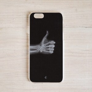 Custom Thumbs Up X-Ray Phone Case: Rad Tech Gift