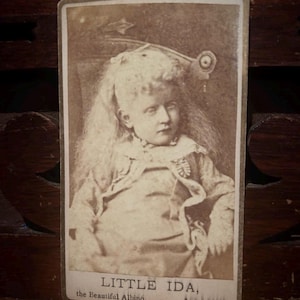 19th century CDV of sideshow performer Little Ida, the Beautiful Albino, 5 years old. ODDITIES