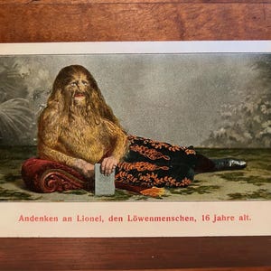 Circa 1920 postcard of Lionel the Lion Faced Boy ODDITIES