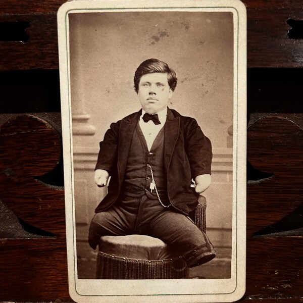 Circa 1870s CDV of limbless sideshow performer Walter H. Stuart