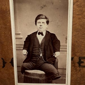 19th century CDV of limbless wonder sideshow performer Walter Stuart. ODDITIES