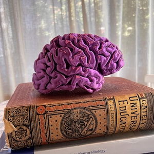 May include: A purple brain model rests atop a stack of books. The top book is a vintage edition with the title "Gately's Universal Educator Illustrated." Below are books with titles including "Top 3 Differentials in Neuroradiology" and "How Do You Feel?"