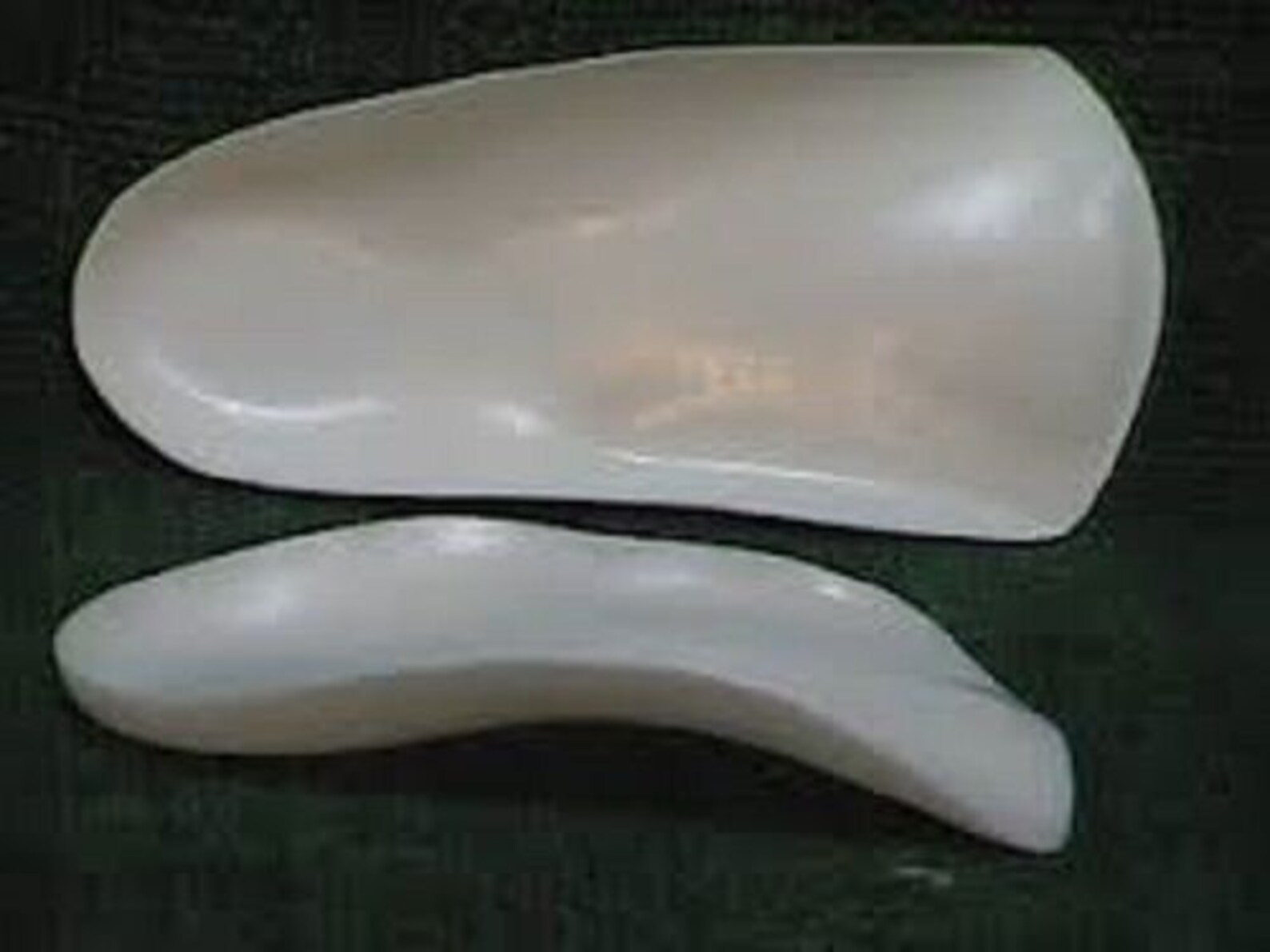 1 Pair of Custom Orthotics Custom Arch Supports for Feet Etsy