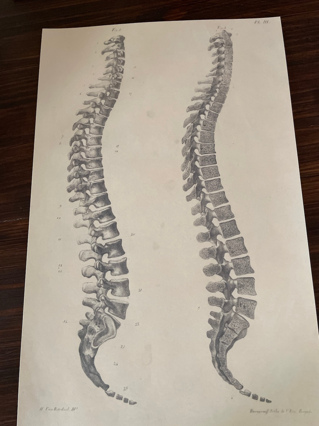 Antique Anatomy Print Spine Skeleton Medical Oddities A11 - Etsy