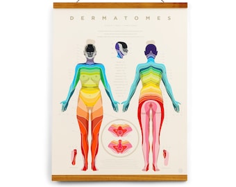 Dermatome Map 17" x 22" Print • Acupuncture, Physical Therapy, Anatomy, Chiropractic, Neurology, Female body, frame optional