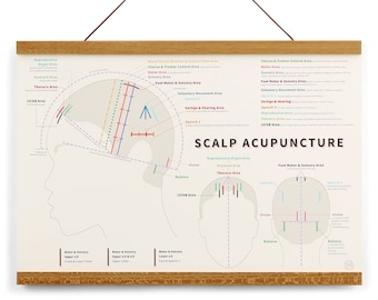 Scalp Acupuncture Print, 2 size options, Chinese Medicine, TCM, frame optional