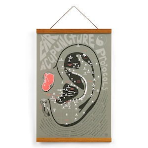 Ear Acupuncture Protocols Print (Muted Black) 13&quot; x 19&quot; • Auricular, Chinese Medicine, TCM, frame optional