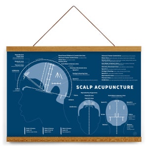 Scalp Acupuncture Print 19&quot; x 13&quot; (Blue), Chinese Medicine, TCM, frame optional