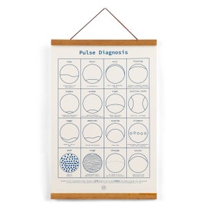 Puls-Diagnose-Druck (Marineblau) 13” x 19” • Chinesische Medizin Akupunktur TCM, optional mit Rahmen