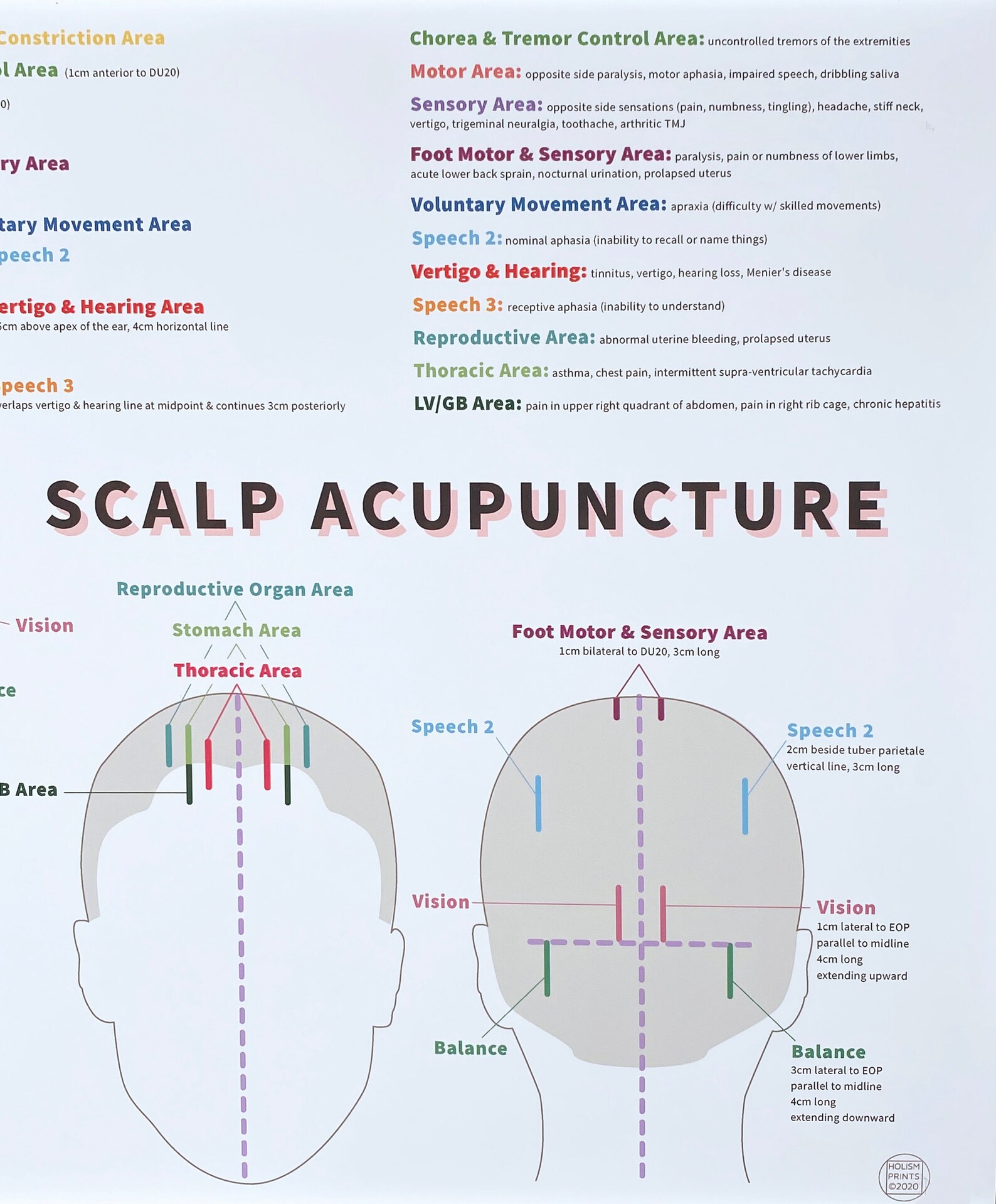Scalp Acupuncture Print 19 x 13 Chinese Etsy