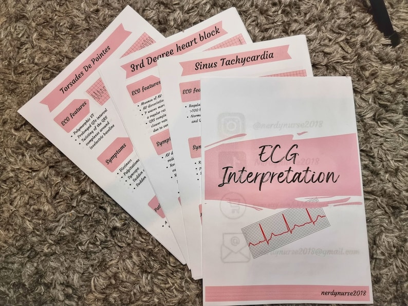 ECG Interpretation Digital Download for Student Nurses - Etsy