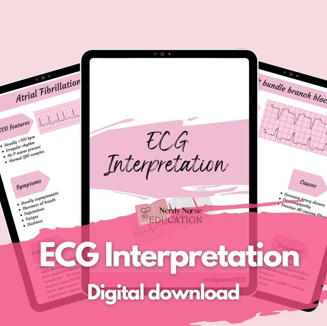 Ecg Interpretation Digital Download For Student Nurses Student