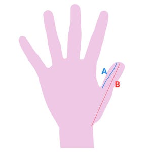May include: A pink hand illustration with lines labeled A and B. A blue line labeled A is drawn on the thumb. A red line labeled B is drawn from the base of the thumb to the tip.