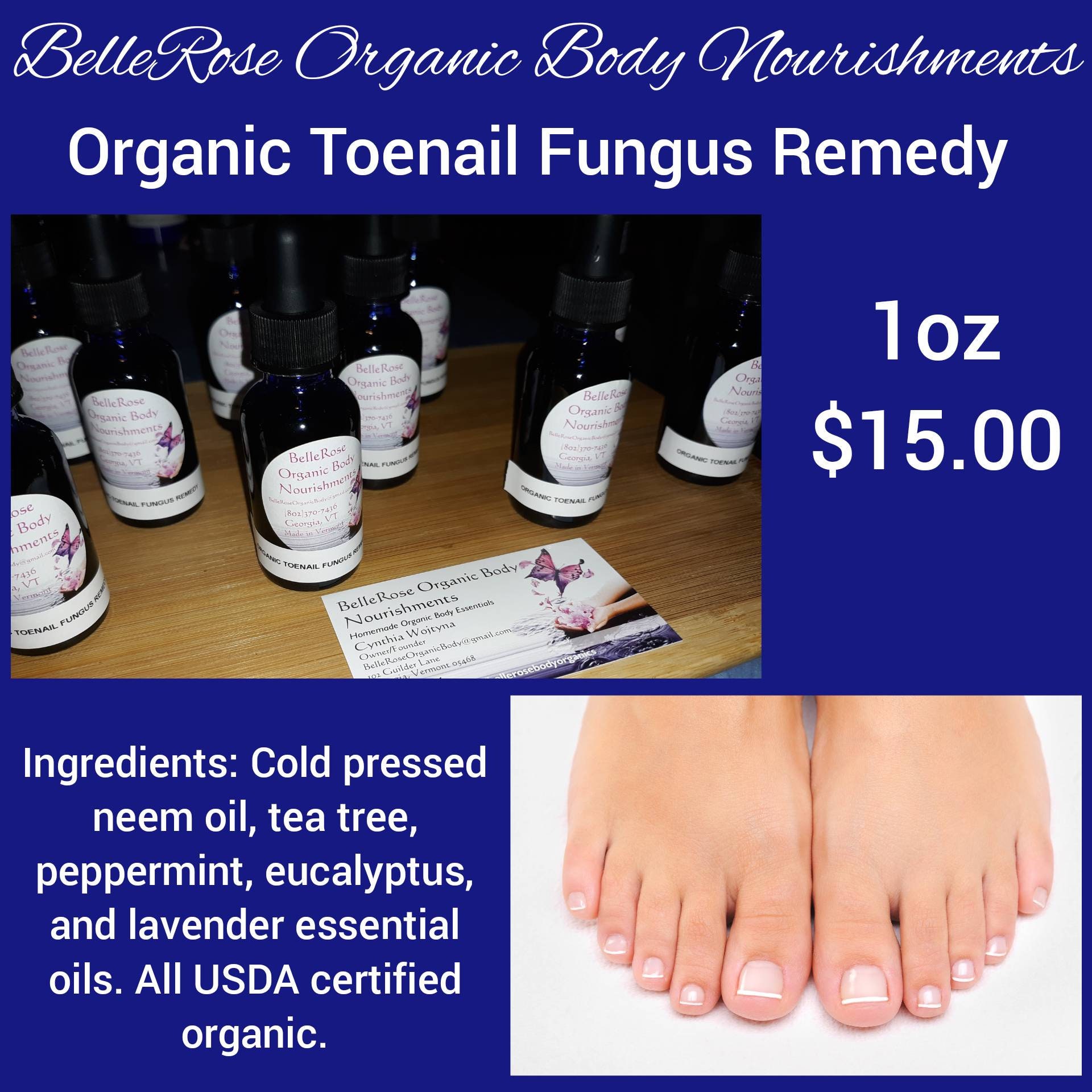 Toenail Fungus Remedy Etsy Canada