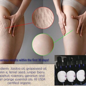 Anti-Cellulite Body Oil (Organic)