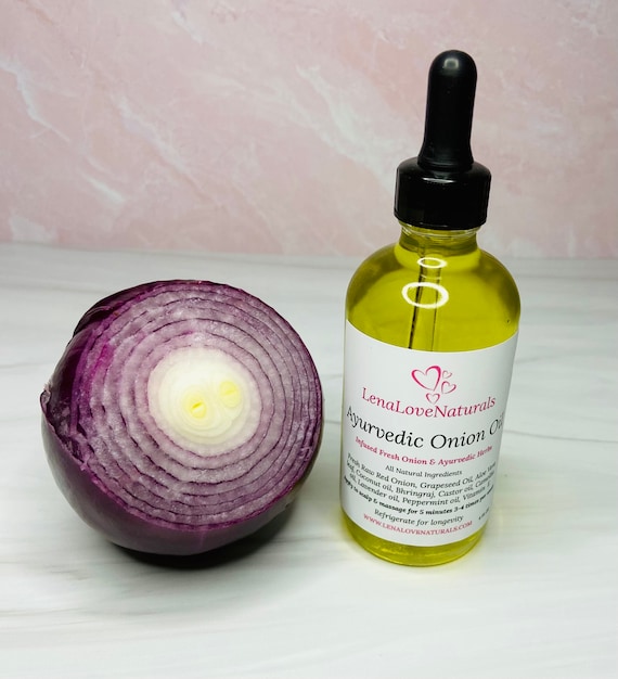 Bio-Ayurveda-Zwiebel-Haarwuchsl mit Aloe Vera und Bhringraj  Natrliche  Haarpflege  Zwiebel-Haarl  Ohne Chemikalien und Konservierungsmittel -  Etsy.de