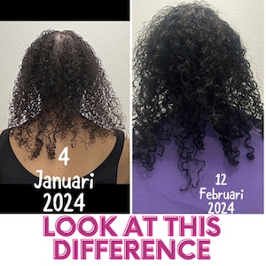 May include: A side-by-side comparison of a person's hair growth. The left image shows the hair on January 4, 2024, and the right image shows the hair on February 12, 2024. The text "LOOK AT THIS DIFFERENCE" is written in pink letters at the bottom of the image.