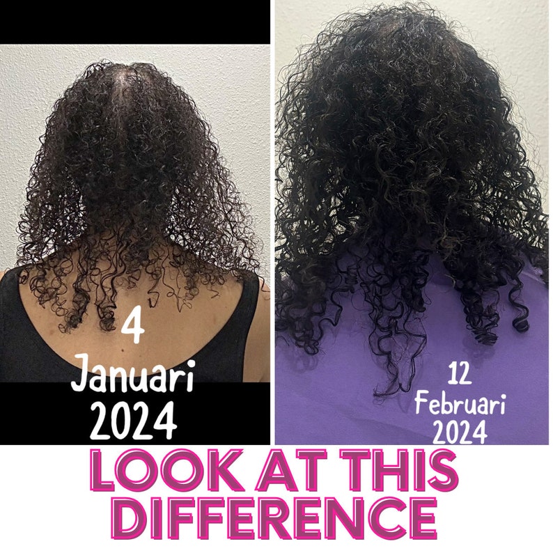 May include: A side-by-side comparison of a person's hair growth. The left image shows the hair on January 4, 2024, and the right image shows the hair on February 12, 2024. The text "LOOK AT THIS DIFFERENCE" is written in pink letters at the bottom of the image.