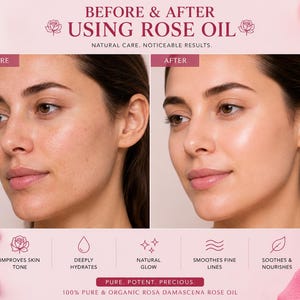 May include: A comparison graphic showing a face before and after using rose oil. Text reads: BEFORE & AFTER USING ROSE OIL, NATURAL CARE. NOTICEABLE RESULTS, IMPROVES SKIN TONE, DEEPLY HYDRATES, NATURAL GLOW, SMOOTHES FINE LINES, SOOTHES & NOURISHES, PURE. POTENT. PRECIOUS. 100% PURE & ORGANIC ROSA DAMASCENA ROSE OIL.