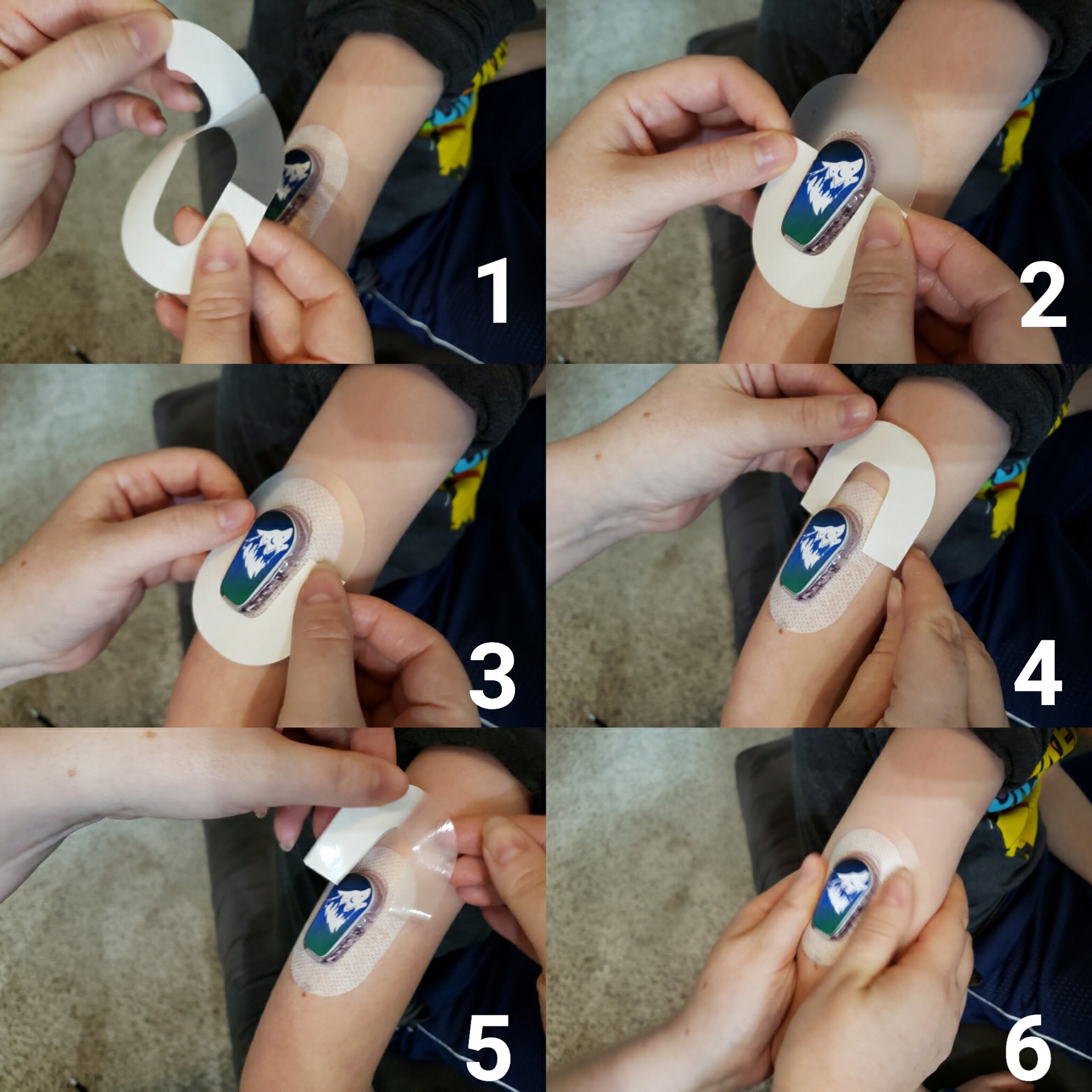 G6 Sensor Mermaid Overlay Tape Tape Patch Cover