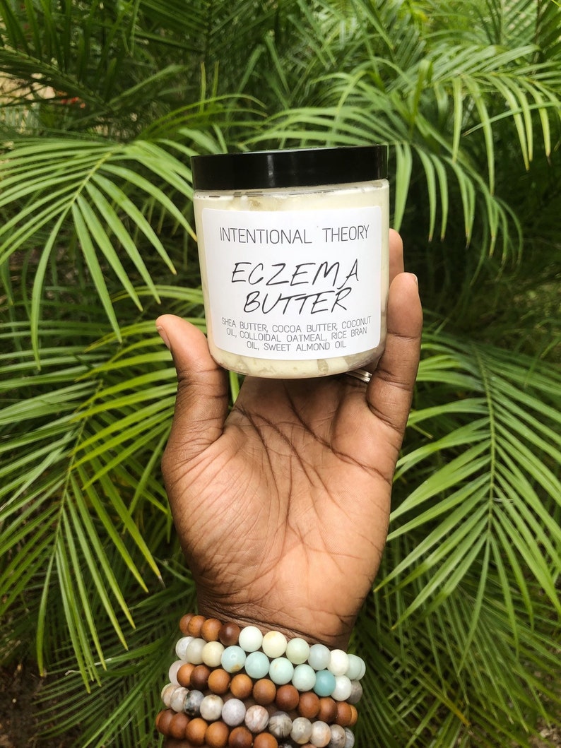 Eczema Body Butter Eczema Relief Body Cream Shea Butter Etsy