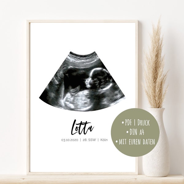 Ultraschallbild ab 11,90 Euro Geburtsposter personalisiert Schwangerschaft Babyparty Geburtsdaten Kinderzimmer Bild Geschenk