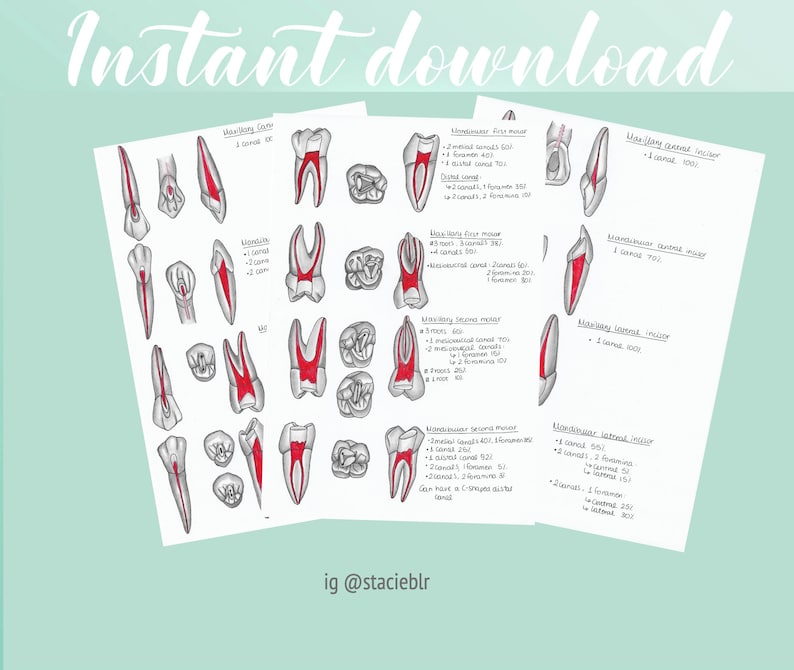 Endodontic Access Diagrams Root Canal Therapy for Endodontics Etsy UK