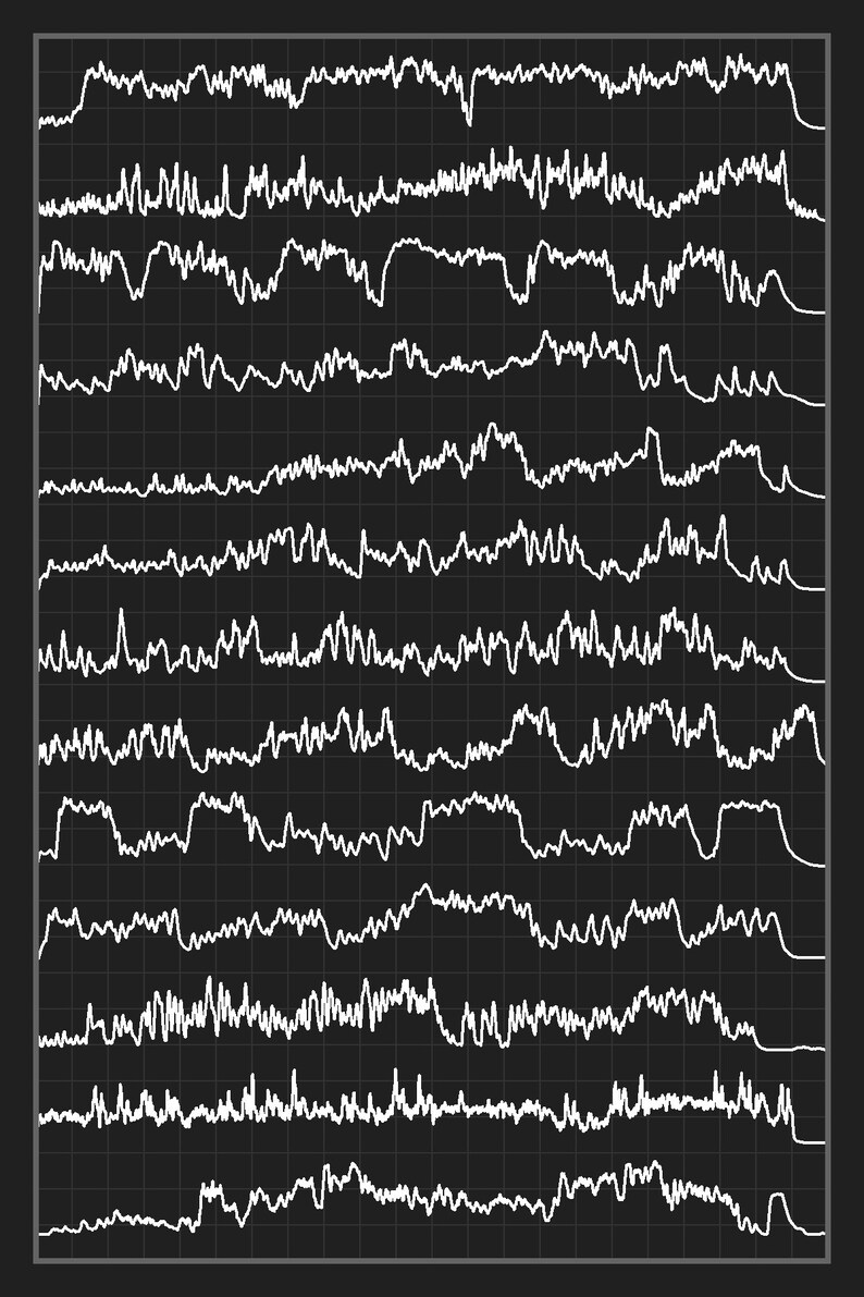 K&ouml;nnte beinhalten: Ein Schwarzwei&szlig;bild einer Hirnwellenmessung. Das Bild zeigt eine Reihe von Linien, die die Gehirnaktivit&auml;t darstellen. Die Linien sind in einem Raster angeordnet, wobei jede Linie einen anderen Teil des Gehirns darstellt.