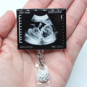 Ultrasound Tech Badge Reel, Ultrasound Tech, Ultrasound, Ultrasound Techician, Sonographer, Badge Reels, Ultrasound Badge , ID Holder, RDMS