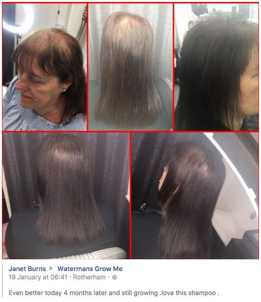 Hair Loss Shampoo Etsy Best Hair Growth Shampoo UK Made Etsy UK