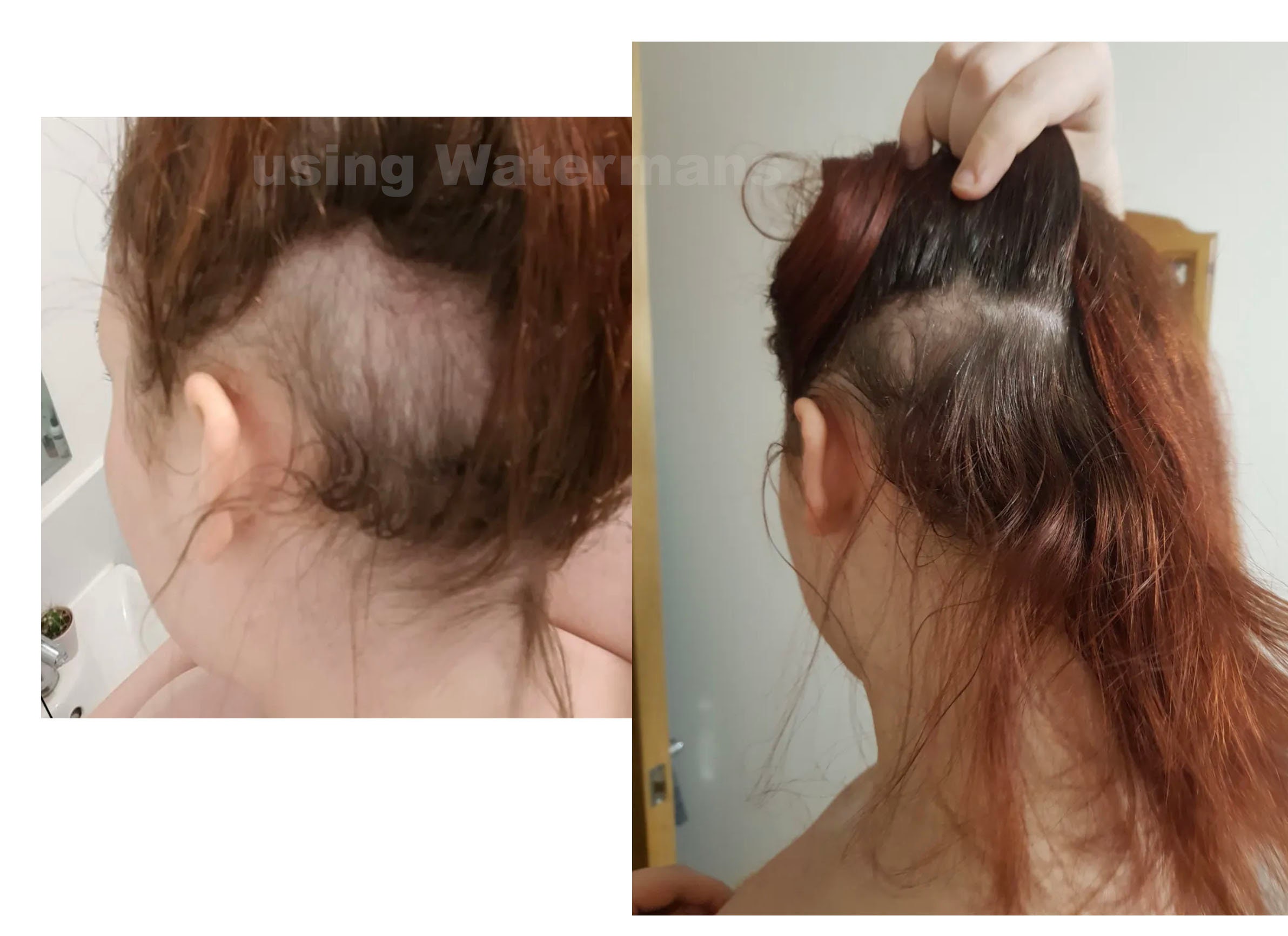 Hair Loss Serum Scalp Treatment Only Promotes Hair Growth - Etsy Sweden