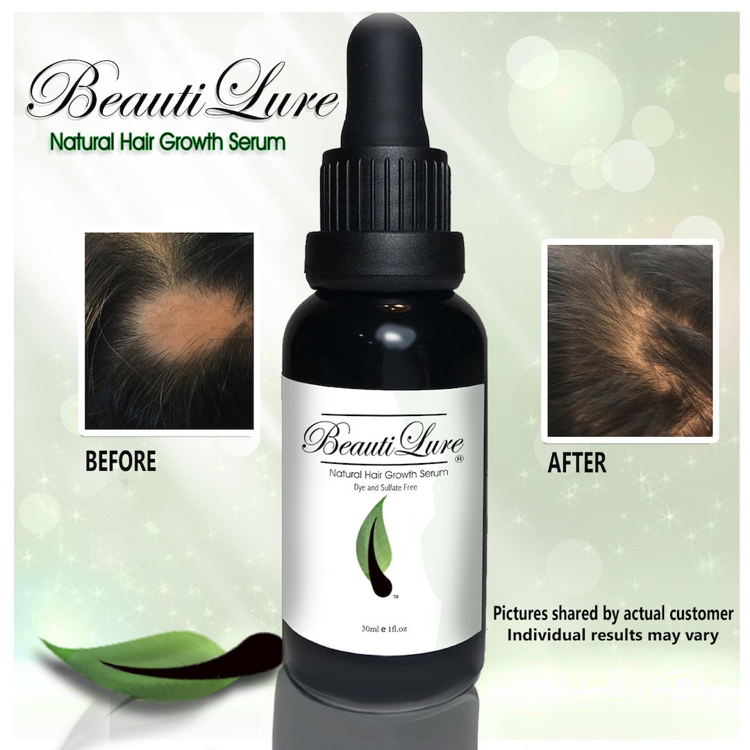 Hair Growth and Dry Scalp Serum Etsy