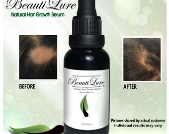 Hair growth and dry scalp serum