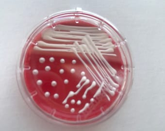 E.Coli Blood Petri Dish Keychain / Microbiology Agar Art / Bacteria Science Lab Gift / Science Art