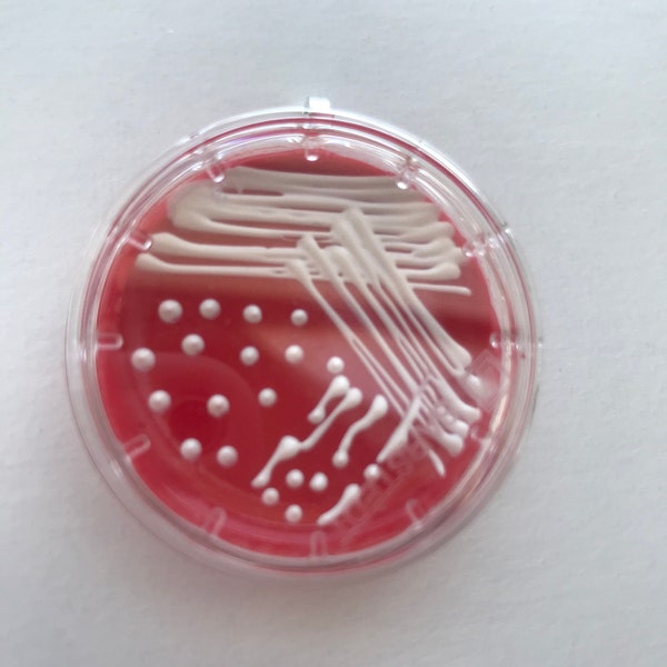 E.Coli Blood Petri Dish Keychain / Microbiology Agar Art / Bacteria Science Lab Gift / Science Art