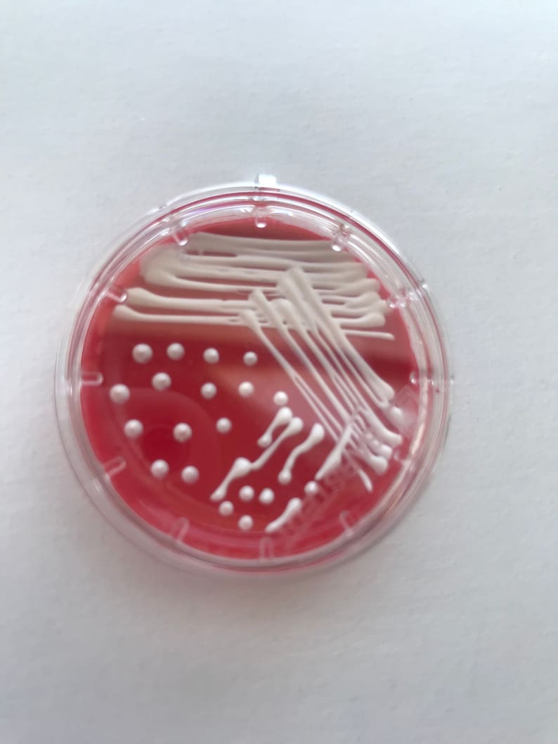Op de afbeelding: Een petrischaal met een rode agarbasis en witte bacteriegroei in een streepvorm.
