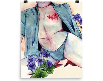 Anemone Top Surgery Posters | Posters Sizes 10x10 to 24x36 inches Transgender Queer Watercolor Mixed Media Paintings Art Prints