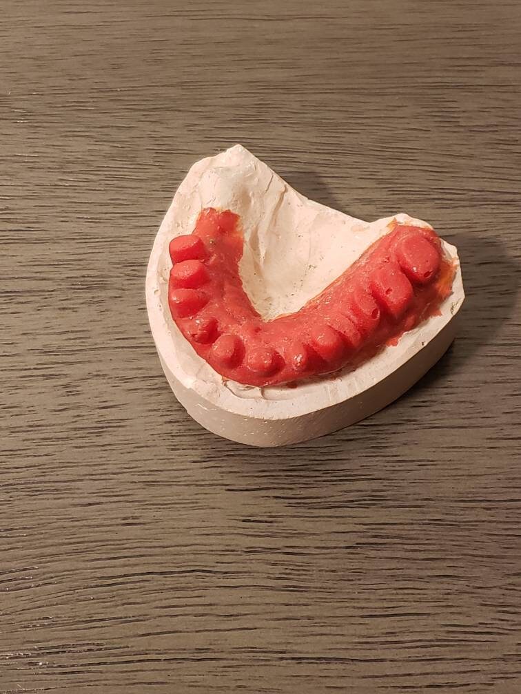 Dental mold Etsy