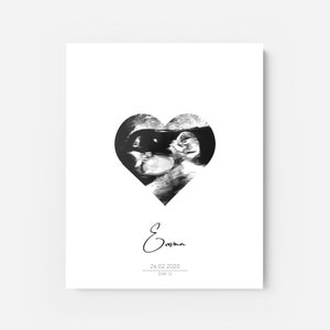 Ultrasound image heart shape personalized