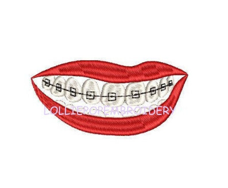 Instant Download Mouth With Braces Machine Embroidery Etsy