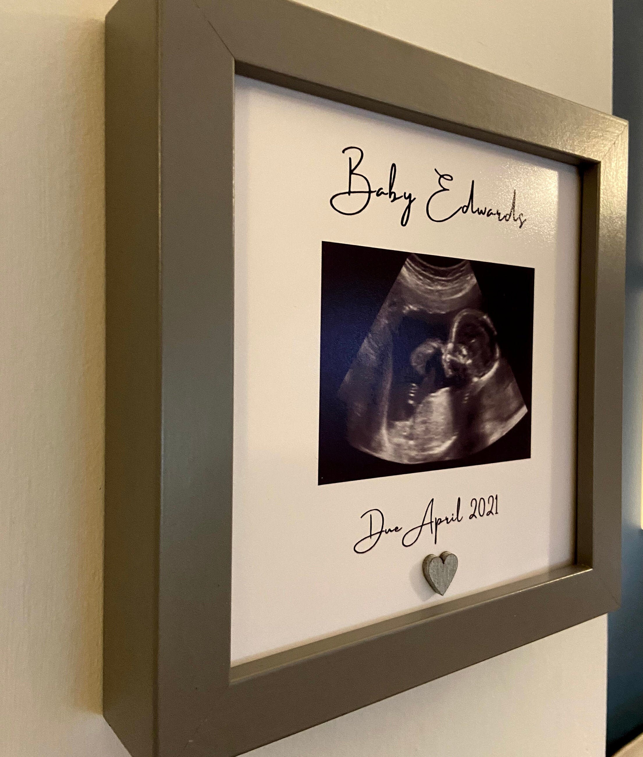 Baby Scan Photo Frame Perfect for Pregnancy Reveal Etsy