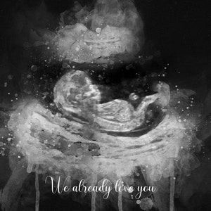 Baby Shower Gift Watercolor Ultrasound Art Print Custom Nursery Decor Gender Reveal Name Reveal Sonogram Gifts Pregnancy Gift